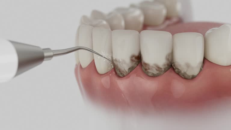 Reliable Dental contractor in Dublin, TX by Smile Center Dentistry